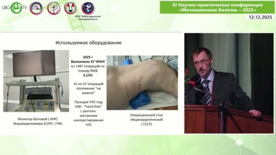 Коновалов С.Е. - Видеопрезентация перкутанной нефролитолапаксии