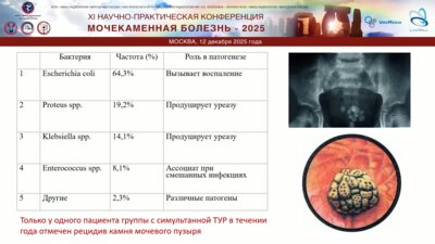 Малинин Г.Ю. - Лечение гиперплазии предстательной железы и конкрементов мочевого пузыря