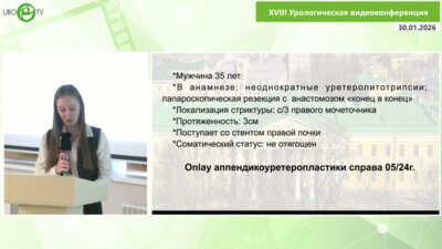 Гулиев Б.Г. - Аппендикулярная onlay-пластика мочеточника при рецидивной стриктуре: малоинвазивное устранение осложнений