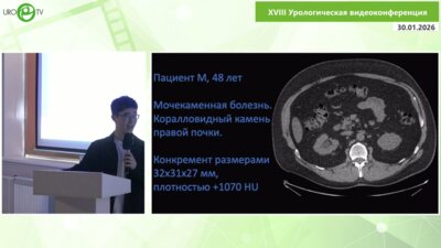 Искандеров А.М. - Техника "передачи конкремента" при симультанной гибкой анте- и ретроградной нефроуретеролитотрипсии с аспирацией