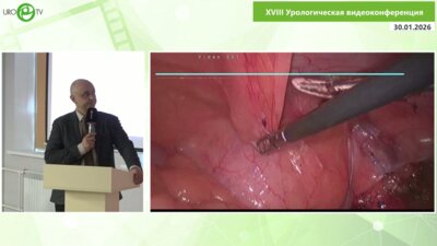 Шкодкин С.В. - Нейрогенная дисфункция мочевого пузыря и рецидивная стриктура левого мочеточника, лапароскопическая пластика
