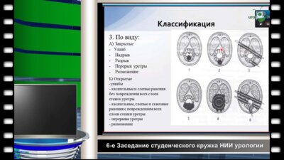 Печеркин А.А. - Повреждение уретры
