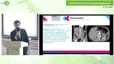 Абдулкеримов Г.Э. - Ретроперитонеоскопическая резекция опухоли почки