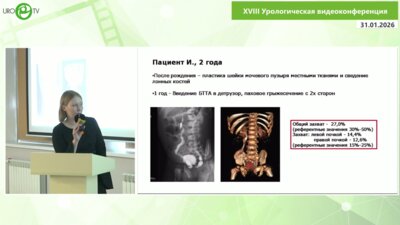 Пепеляева И.М. - Оперативное лечение экстрофии мочевого пузыря