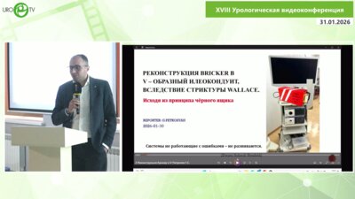 Петросян Г.С. - Реконструкция Bricker в V-образный илеокондуит вследствие стриктуры Wallace