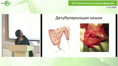 Петрухина Ю.В. - Результаты создания артифициального мочевого пузыря у детей с пороками развития нижних мочевых путей