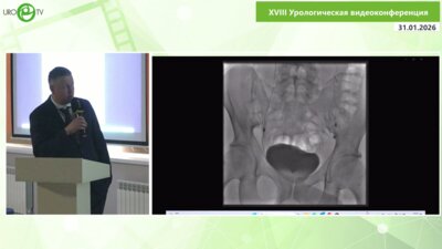 Пинчук И.С. - Эндоваскулярная урология