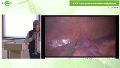 Сергеев В.П. - Интраоперационные осложнения резекции почки - нефрэктомии