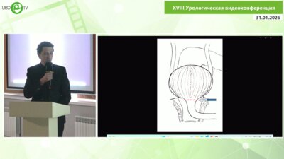 Степанченко В.С. - Лапароскопическая пластика уретро-ректального свища после РПЭ