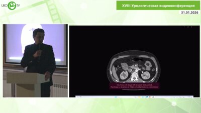 Степанченко В.С. - Лапароскопическая транспозиция ретрокавального мочеточника