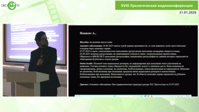 Тивтикян А.С. - Операция Хольцова при непротяжённой стриктуре уретры