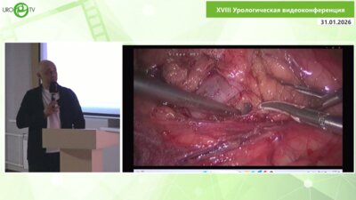 Шкодкин С.В. - Опухоль и киста синуса левой почки