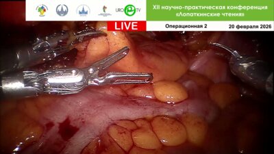 Робот-ассистированная простатэктомия. Модераторы Пушкарь Д.Ю., Галлямов Э.А., Шпоть Е.В. Оператор: Неизвестный мастер