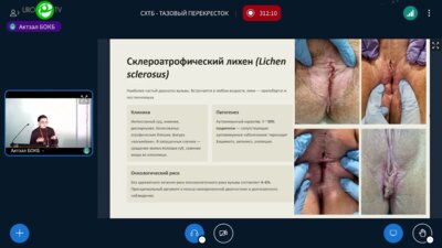 Ломанова Г.А. - Невоспалительные дерматозы вульвы и промежности