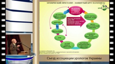 Баныра О.В. - "Использование селективных альфа 1-адреноблокаторов в лечении пациентов с хроническим простатитом"