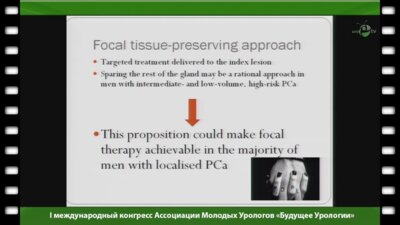 Хьюри Е. - "Фокальная терапия в лечении рака простаты. Новые технологии"