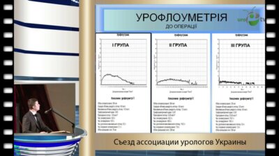 Шмуличенко О.В. - "Критерии обратимости патофункциональных изменений мочевого пузыря после хирургического лечения по причине ДГПЖ"