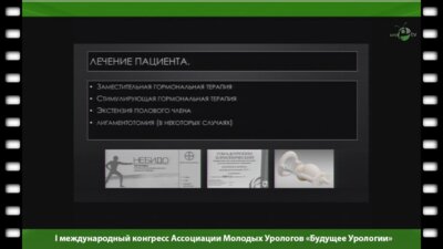 Сокольщик М.М. - "Сексуальная реабилитация пациентов с гипогонадизмом"