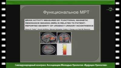 Касян Г.Р. - "Гиперактивный мочевой пузырь"