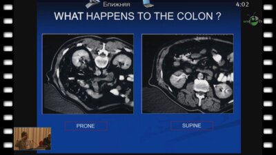 Trinchiery A. - "PCNL обновления" 