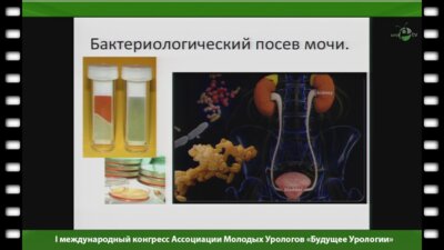 Тищенко Г.Е. - "Верификация микроорганизмов у амбулаторных и стационарных пациентов урологического профиля"