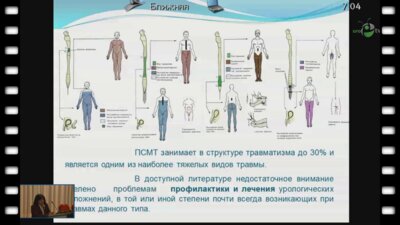 Кан О.Б. - "Профилактика мочекаменной болезни у больных с позвоночно-спинномозговой травмой"