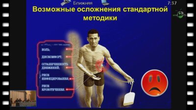 Насиров Ф.Р. - "Бездренажная ПКНЛТ – опыт нашей клиники"