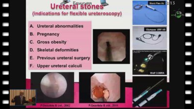 Geavlete P. - "Обновления в уретреоскопии"
