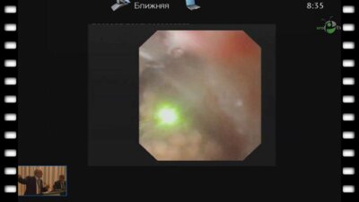 Geavlete P. - "Видео fURS"