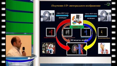 Глыбочко П.В., Фиев Д.Н. - "Компьютерное моделирование, виртуальные и реальные операции при заболеваниях почек"