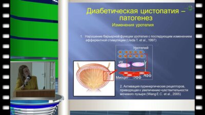 Шабудина Н.О. - "Диабетическая цистопатия патогенез и клиническое течение"