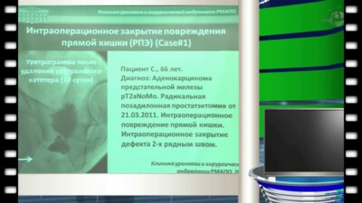 Богданов А.Б. - "Диагностика и лечение уретро - прямокишечных свищей"
