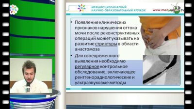 Галиев Н.А. - "Оказание помощи амбулаторным пациентам после перенесенных урологических операций"