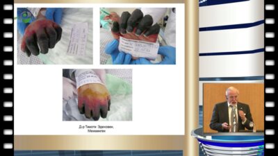 Johansen T. - "Инфекционные осложнения при биопсии простаты"