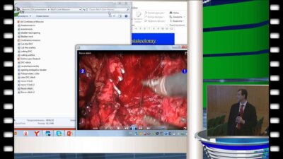 S.Gozen - Robot - assisted radical prostatectomy