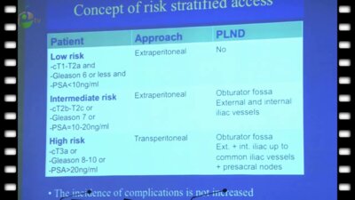Jens-Uwe Stolzenburg - Эволюция радикальной простатэктомии