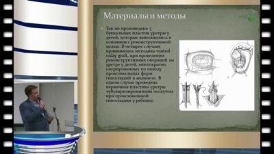 В.Д. Титов - К вопросу о выборе метода пластики уретры у детей