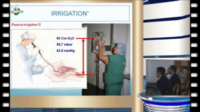 A. Ploumidis, Athens (GR) -  Оборудование, показания и техника выполнения ретроградной интраренальной хирургии