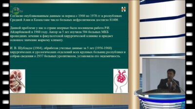 Ч.Б. Алимов - Состояние мочекаменной болезни в Кыргызстане