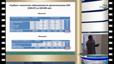 Старцев В.Ю. - Актуальные показатели онкоурологической службы в Санкт-Петербурге