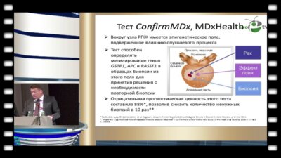 Каприн А.Д. - "Молекулярно-биологические факторы прогноза у больных раком простаты"