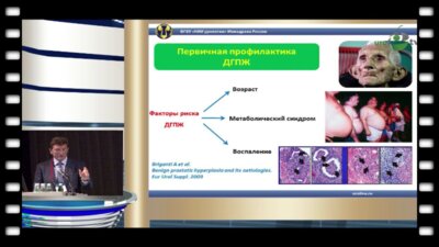 Аполихин О.И. - "Третичная профилактика как экспертиза контроля качества урологической помощи в России"