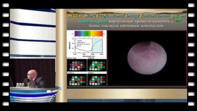 Мартов А.Г. - "Современные методы эндоскопической диагностики и лечения папиллярных опухолей ВМП"