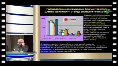Дутов В.В. - "Интегративные подходы к диагностике и малоинвазивному лечению мочекаменной болезни аномалийных почек у взрослых и детей"