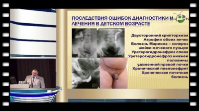 Павлов А.Ю. - "Интегративные преемственные подходы в детской и взрослой урологии"