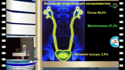 Дутов В.В. - "Новые подходы к медикаментозному лечению камней мочеточника"
