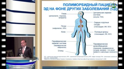 Зырянов С.К. - "Терапия ингибиторами ФДЭ5 у пациентов с различными соматическими заболеваниями"