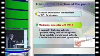 Сае Вонг Ким - Использование HPS лазера у пациентов с высоким риском ДГПЖ