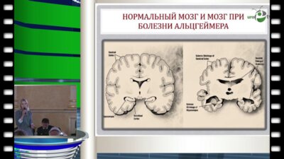 Тишова Ю.А. - Болезнь Альцгеймера - диабет 3 типа?