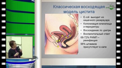 Перепанова Т.С. - Российские национальные рекомендации по антибактериальному лечению и профилактике инфекций нижних мочевых путей